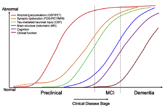 Alzheimer's disease - IASON – Alzheimer's disease: early detection ...